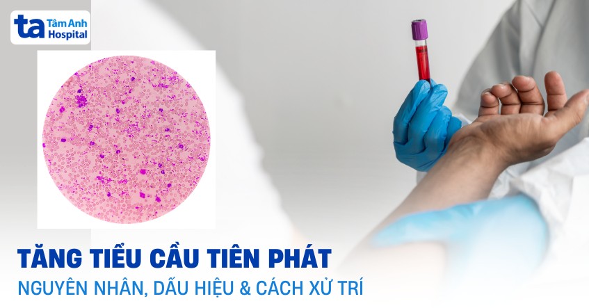 tăng tiểu cầu tiên phát