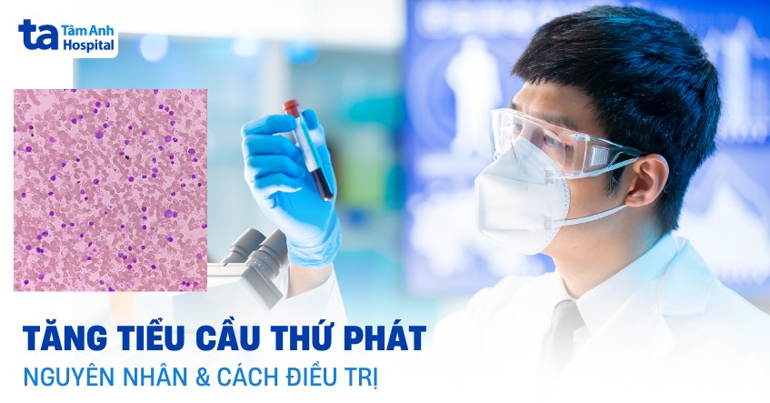 tăng tiểu cầu thứ phát