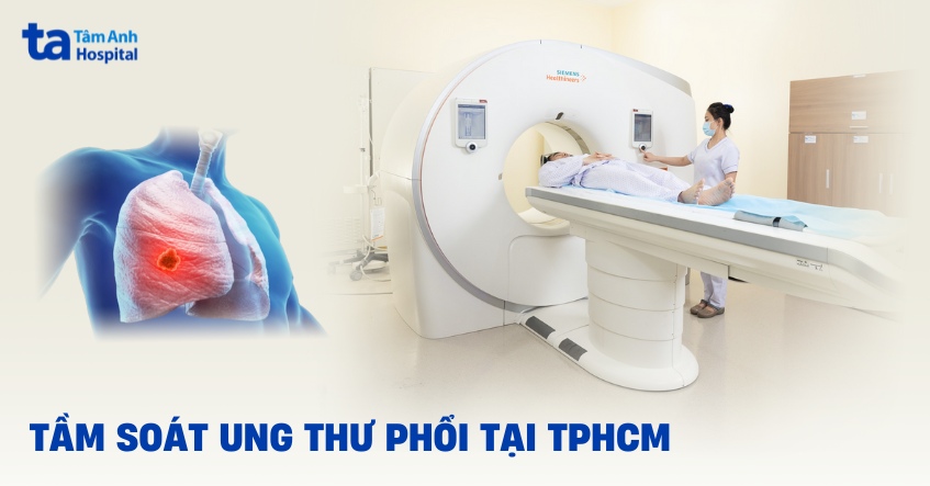 tầm soát ung thư phổi tại tphcm