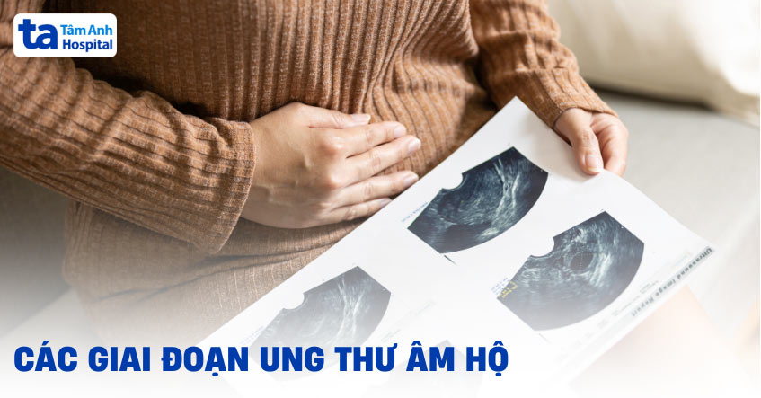 các giai đoạn ung thư âm hộ