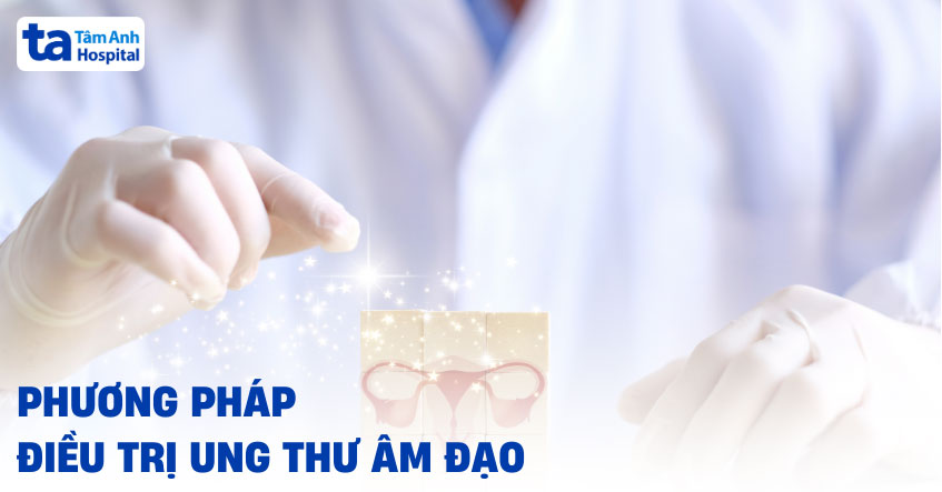 điều trị ung thư âm đạo