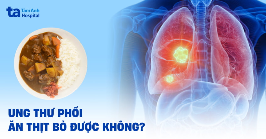 ung thư phổi có ăn được thịt bò không