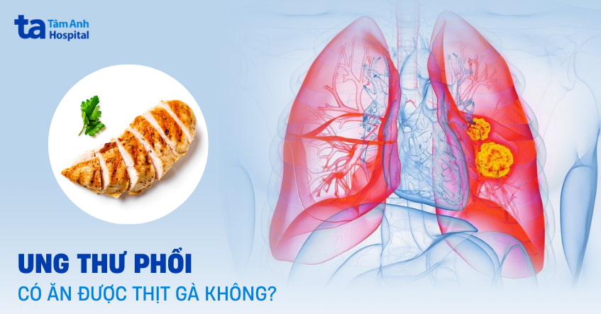 ung thư phổi có ăn được thịt gà không