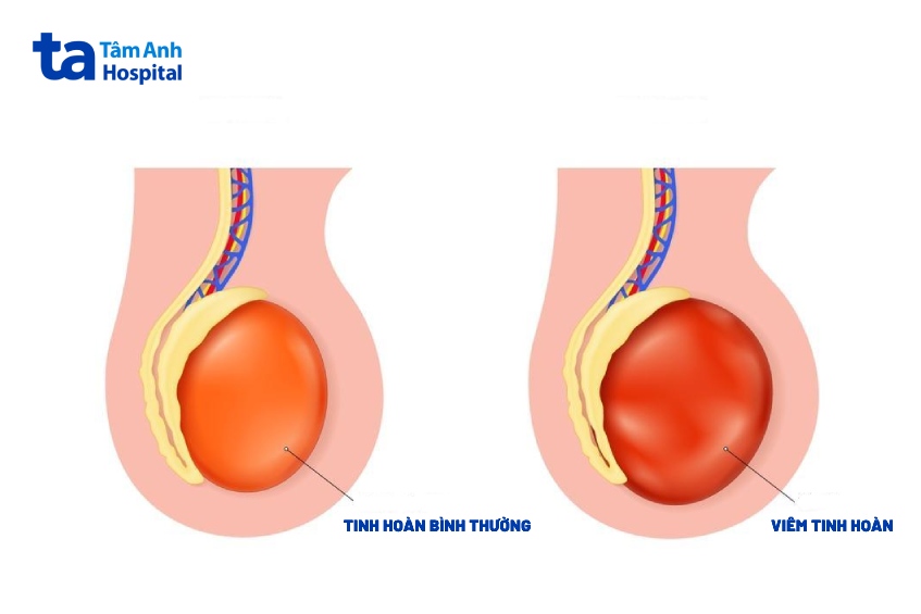 mô phỏng tinh hoàn bình thường