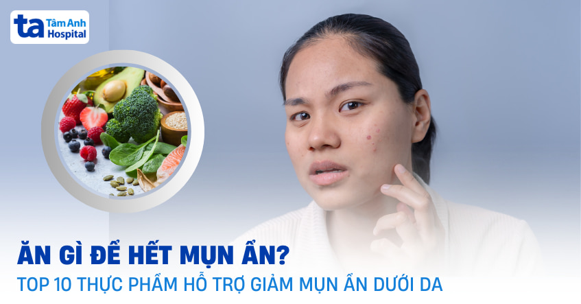 ăn gì để hết mụn ẩn