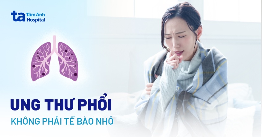 ung thư phổi không phải tế bào nhỏ