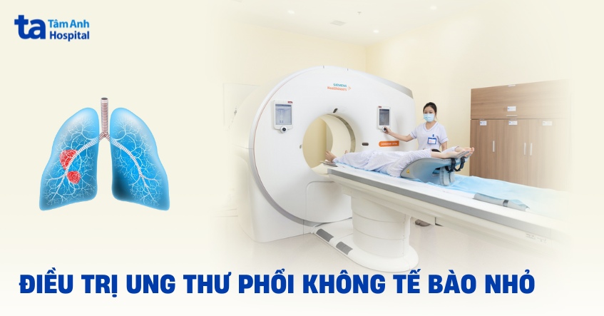 điều trị ung thư phổi không tế bào nhỏ