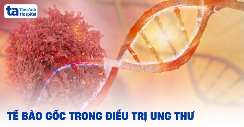 tế bào gốc trong điều trị ung thư