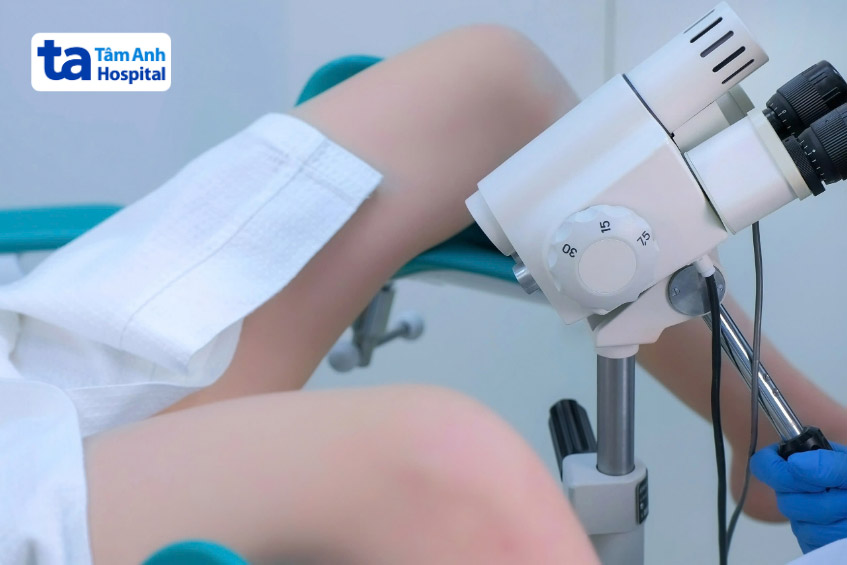 soi cổ tử cung giúp chẩn đoán sức khỏe phụ khoa