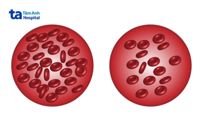 thiếu máu là bệnh lý ở nhiều đối tượng