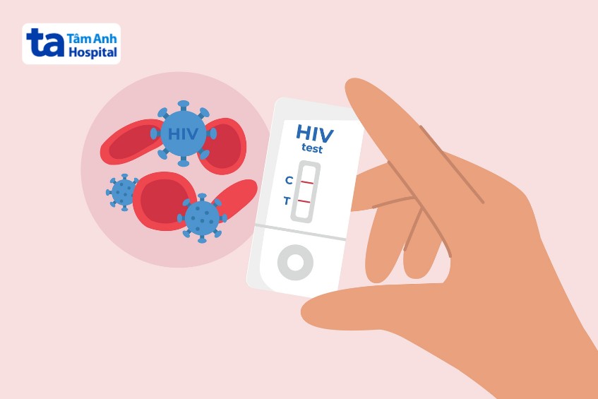 nhiễm hiv có nguy cơ giảm tiểu cầu miễn dịch