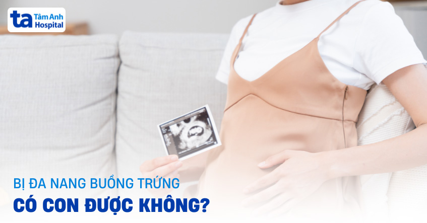 Đa nang buồng trứng có con được không?