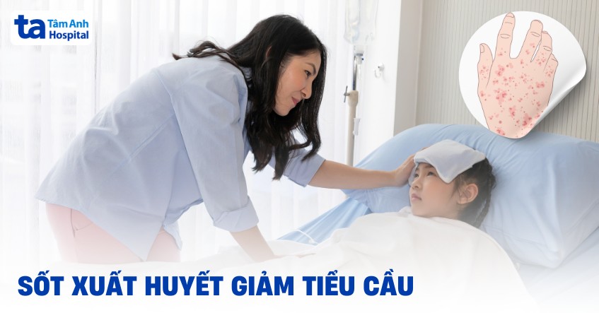 sốt xuất huyết giảm tiểu cầu