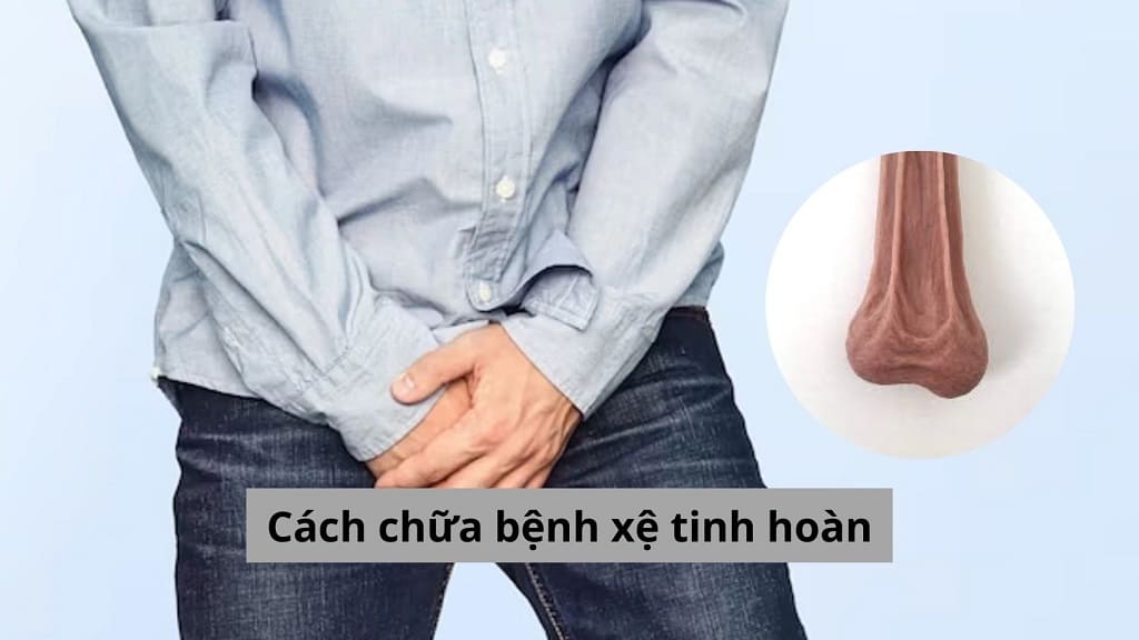 Cách chữa bệnh xệ tinh hoàn