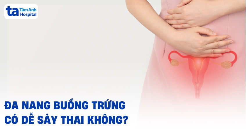 đa nang buồng trứng có dễ sảy thai không