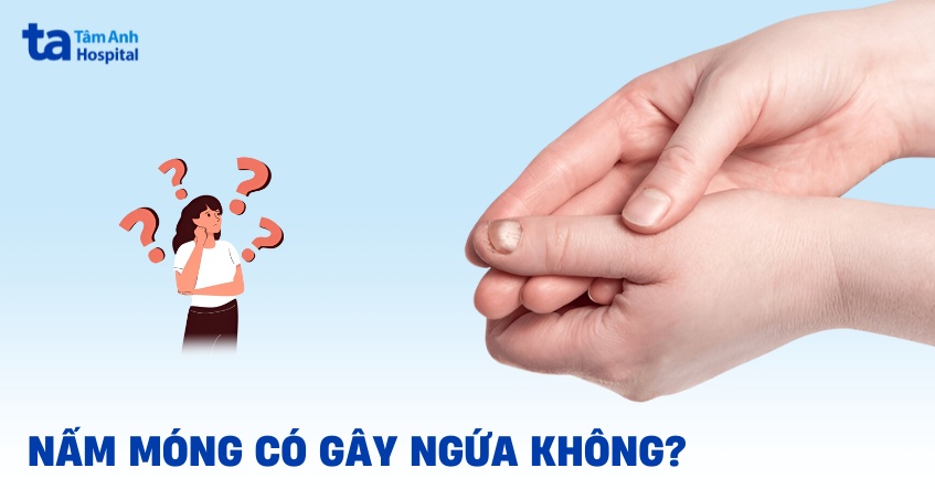 nấm móng có gây ngứa không