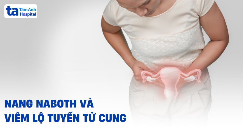 nang naboth và viêm lộ tuyến tử cung