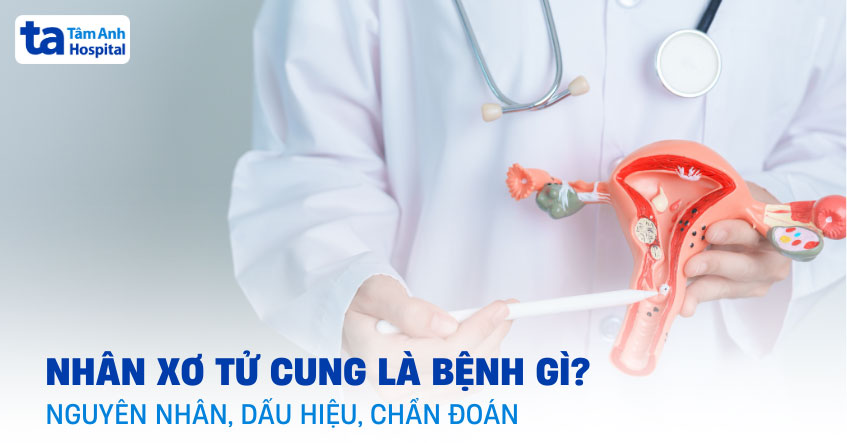 nhân xơ tử cung