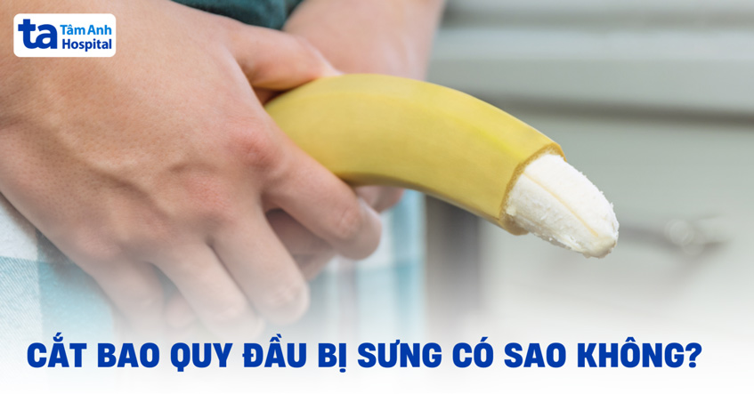 Sau khi cắt bao quy đầu bị sưng có sao không?