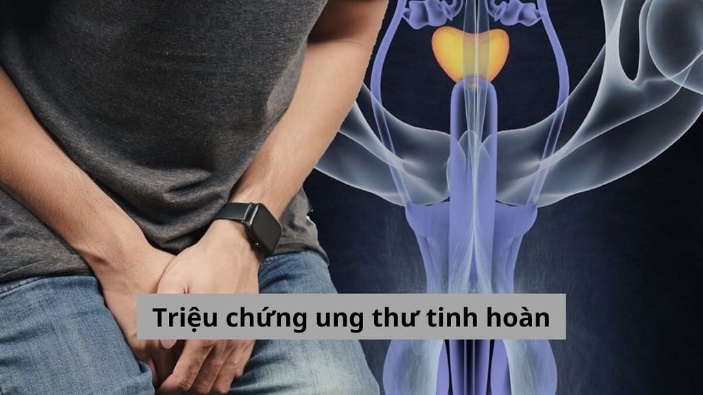 Triệu chứng ung thư tinh hoàn