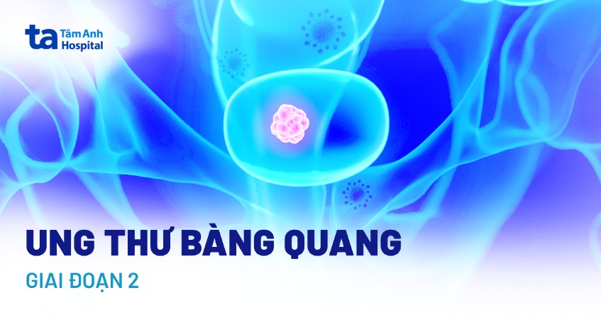 ung thư bàng quang giai đoạn 2