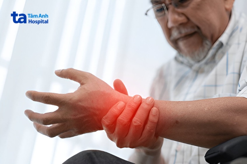 ảnh hưởng của vảy nến lan rộng đến sức khỏe