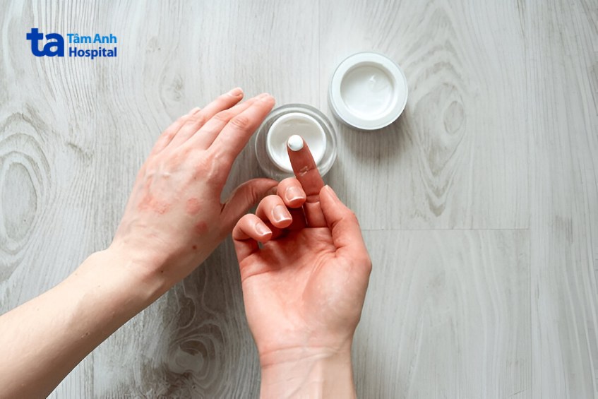 hướng dẫn chăm sóc và một số lưu ý cần biết