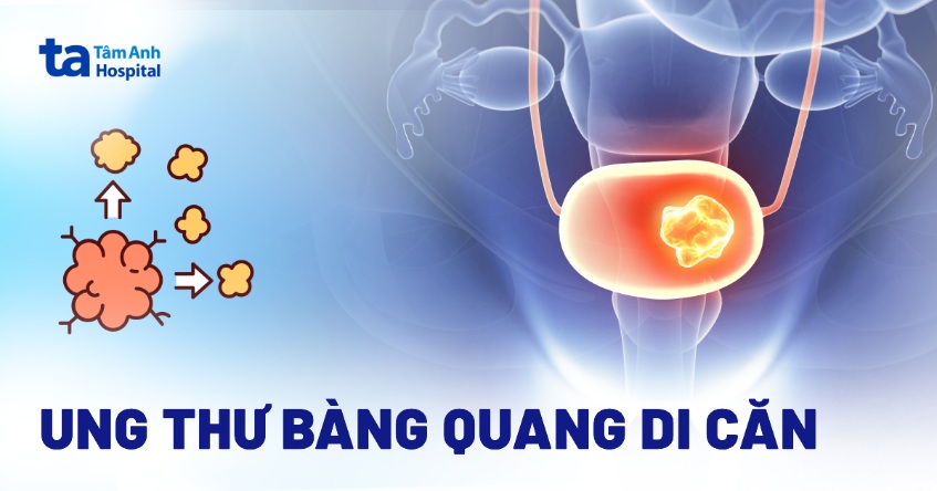 ung thư bàng quang di căn
