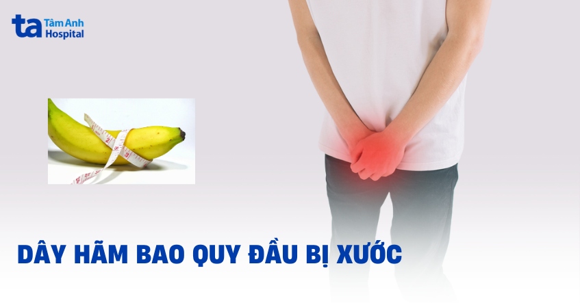 dây hãm bao quy đầu bị xước