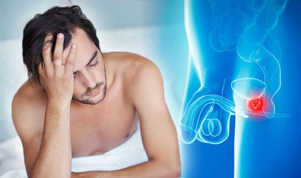 Tinh hoàn bên phải có cục nhỏ - trường hợp nguy hiểm