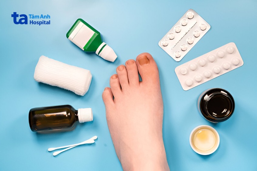 thuốc điều trị nấm móng chân