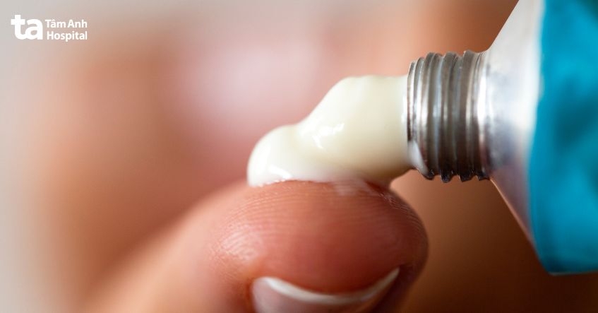 thuốc bôi theo chỉ định bác sĩ