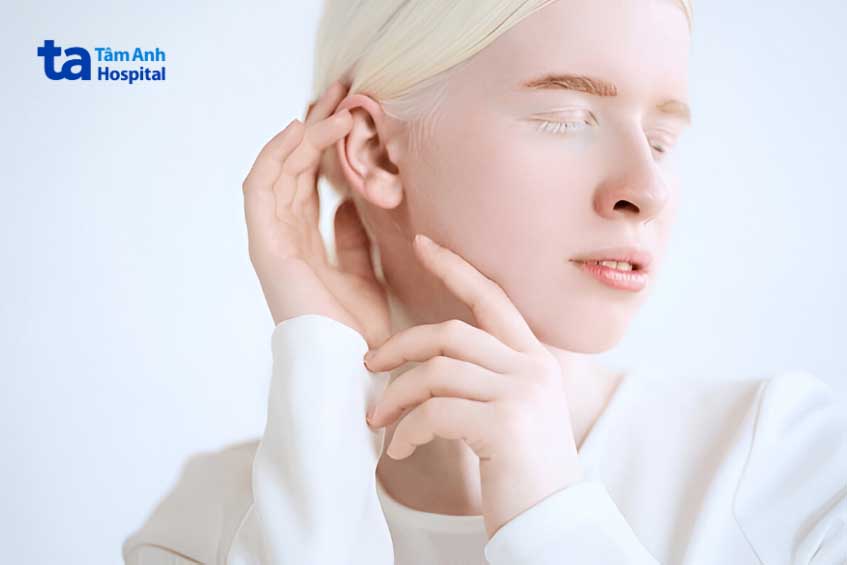 Triệu chứng nhận biết người bạch tạng