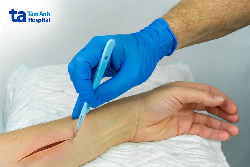 Phẫu thuật là một trong những nguyên nhân gây ra vết thương hở