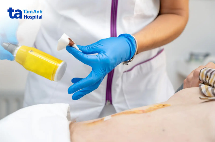 Nhiễm trùng là biến chứng đáng lo hàng đầu khi bị thương