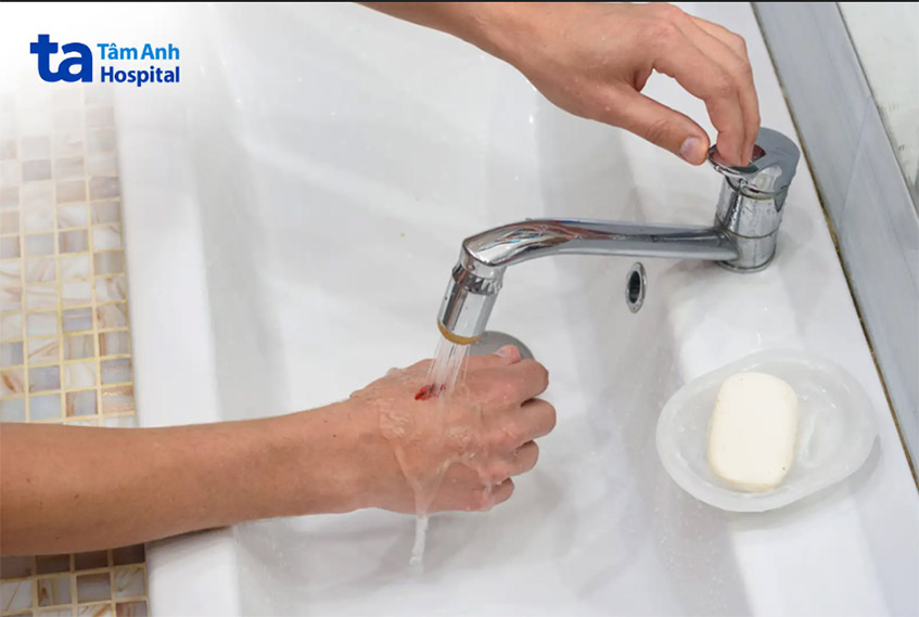 Vệ sinh là việc cần làm đầu tiên trong trong chăm sóc vết thương