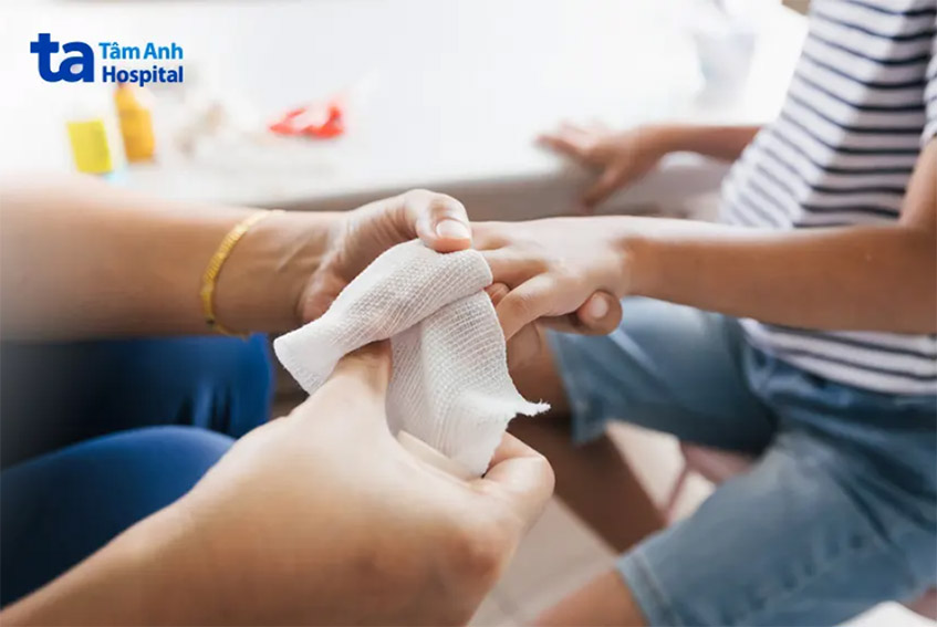 Băng bó quá chặt có thể làm ảnh hưởng đến thời gian hồi phục