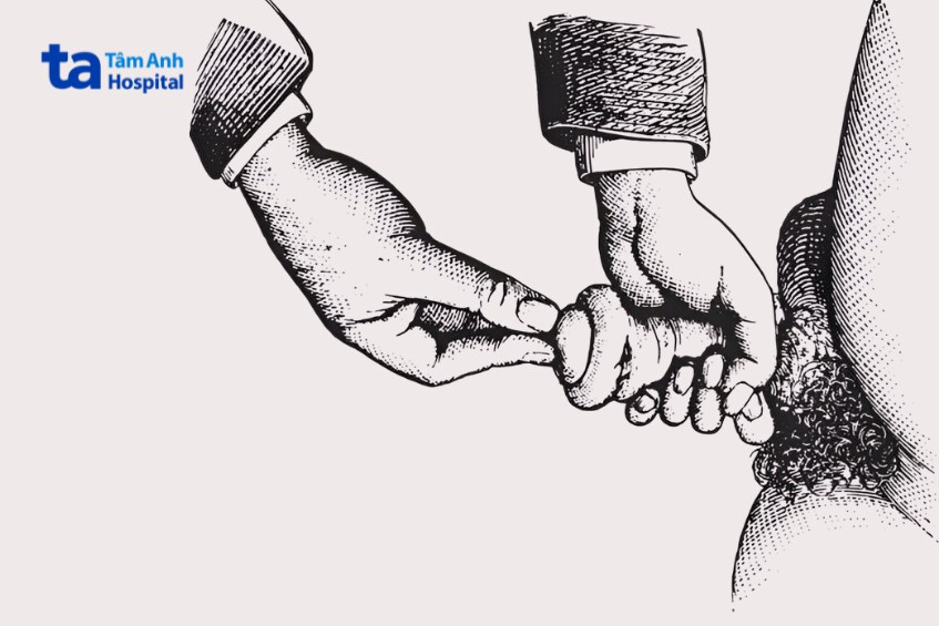 nguyên nhân gây đau khi lột bao quy đầu