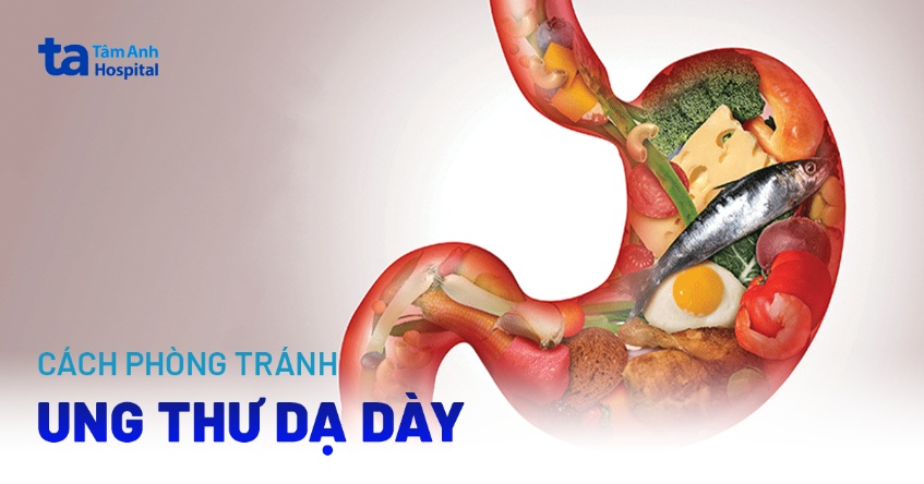 cách phòng tránh ung thư dạ dày
