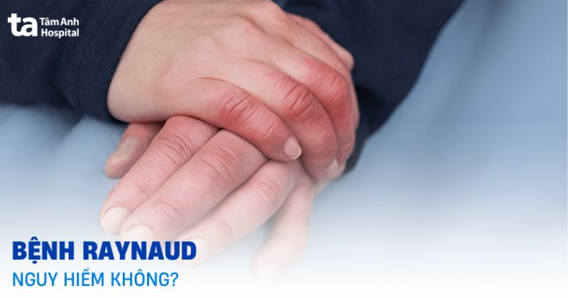 bênh raynaud có nguy hiểm không
