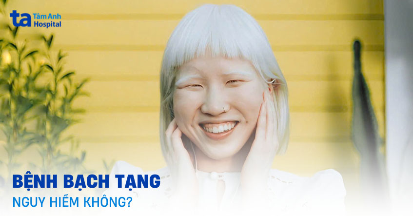 Bệnh bạch tạng có nguy hiểm không
