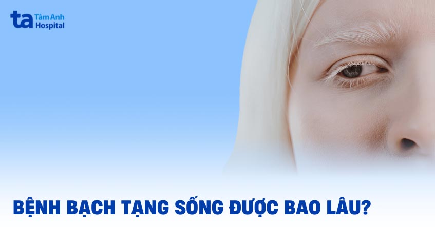 Bệnh bạch tạng sống được bao lâu