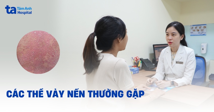 các loại vảy nến và các thể bệnh