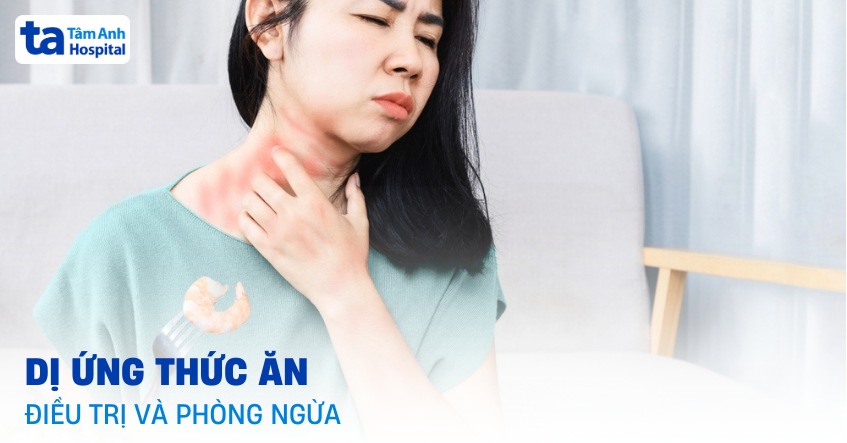 dị ứng thức ăn