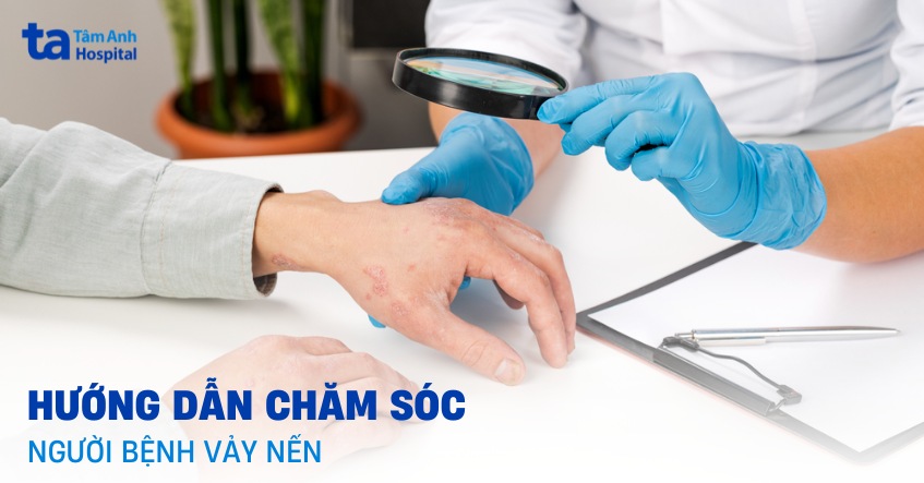 lập kế hoạch chăm sóc bệnh nhân vảy nến