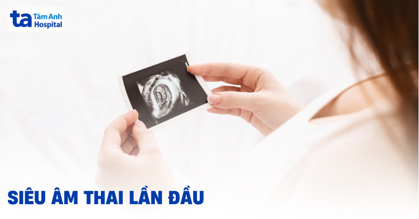 Siêu âm thai lần đầu