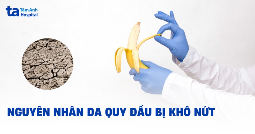 da quy đầu bị khô nứt