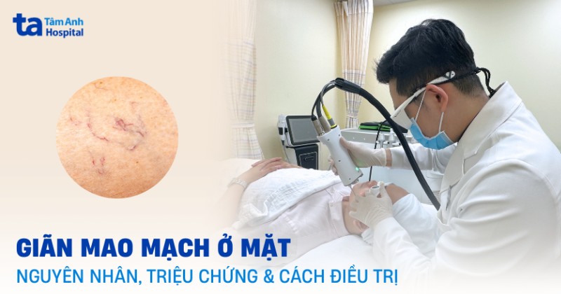 giãn mao mạch ở mặt