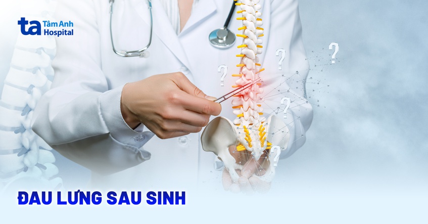 đau lưng sau sinh
