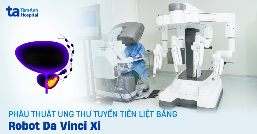 phẫu thuật ung thư tuyến tiền liệt bằng robot davinci xi